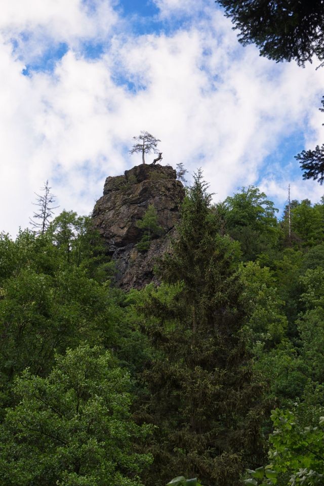 Hirschsprung
